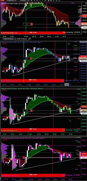 Click to Enlarge

Name: US Min Scalp.JPG
Size: 298 KB