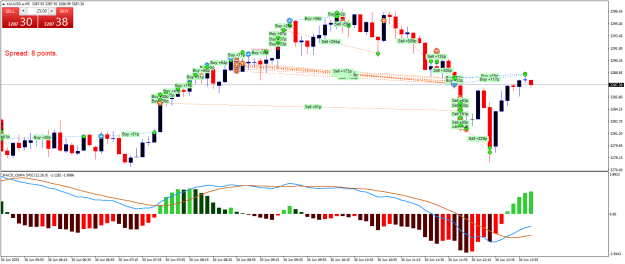 Click to Enlarge

Name: XAUUSD.aM5.png
Size: 27 KB