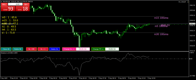 Click to Enlarge

Name: XAUUSDM5.png
Size: 21 KB